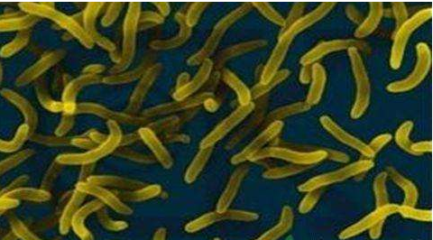 微生物菌劑好？好在哪里您知道嗎？